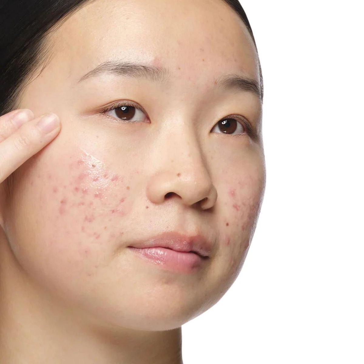 THE ORDINARY - Solucion de Aloe al 2% + NAG 2% The Ordinary