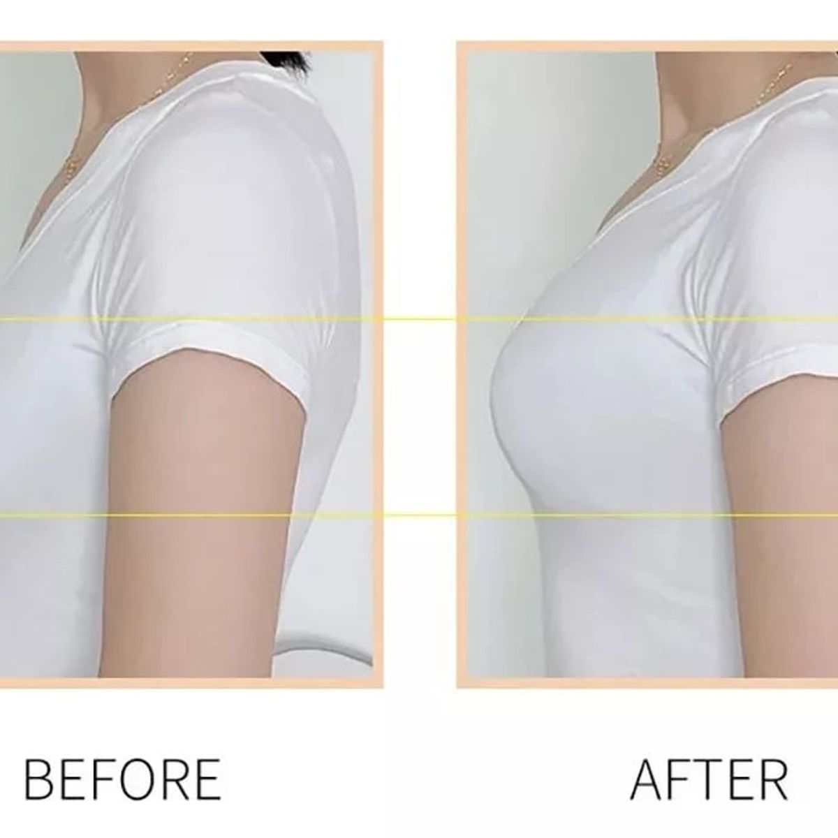 VARIOS - Brasier invisible Sujetador  Autoadhesivo De Silicona