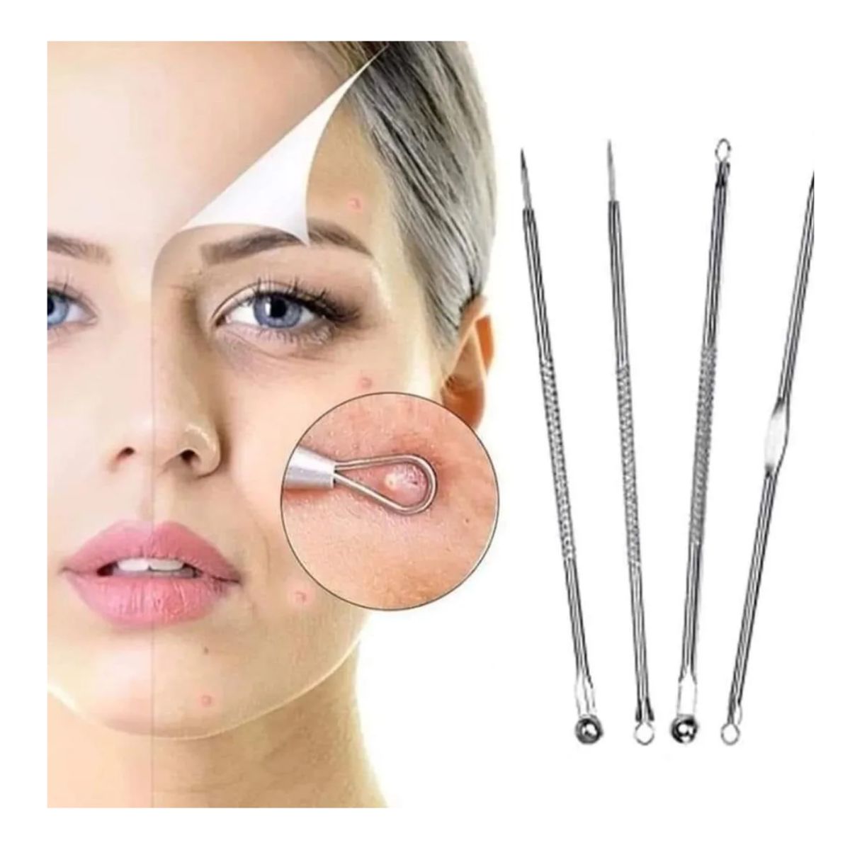 GENERICO - Kit Facial Saca Espinillas