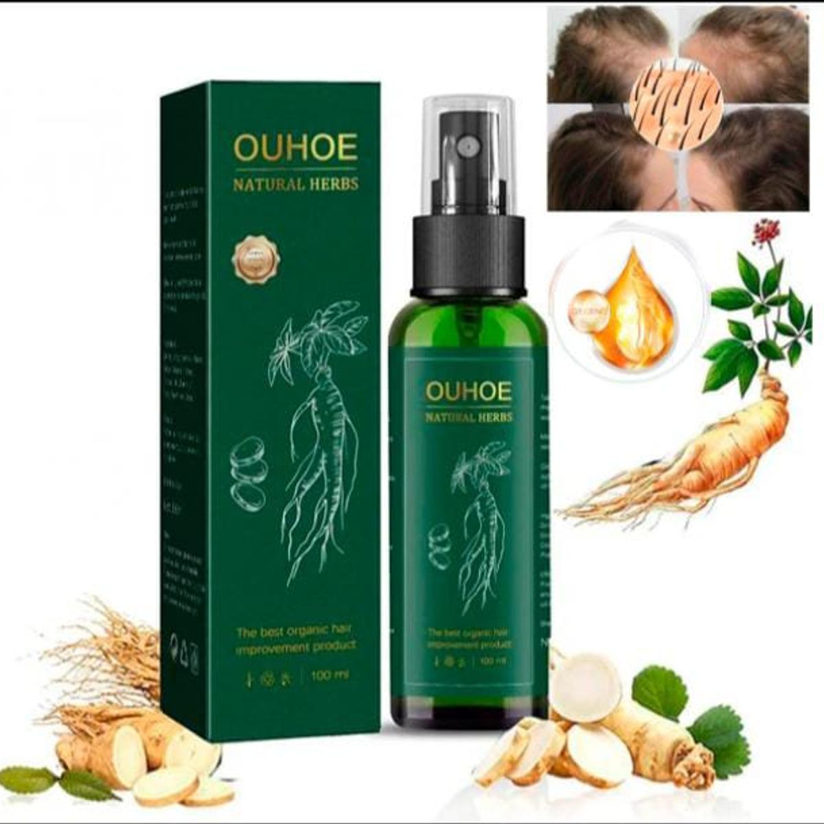 GENERICO - SPRAY DE RECUPERACIÓN DE CABELLO PARA HOMBRE Y MUJER