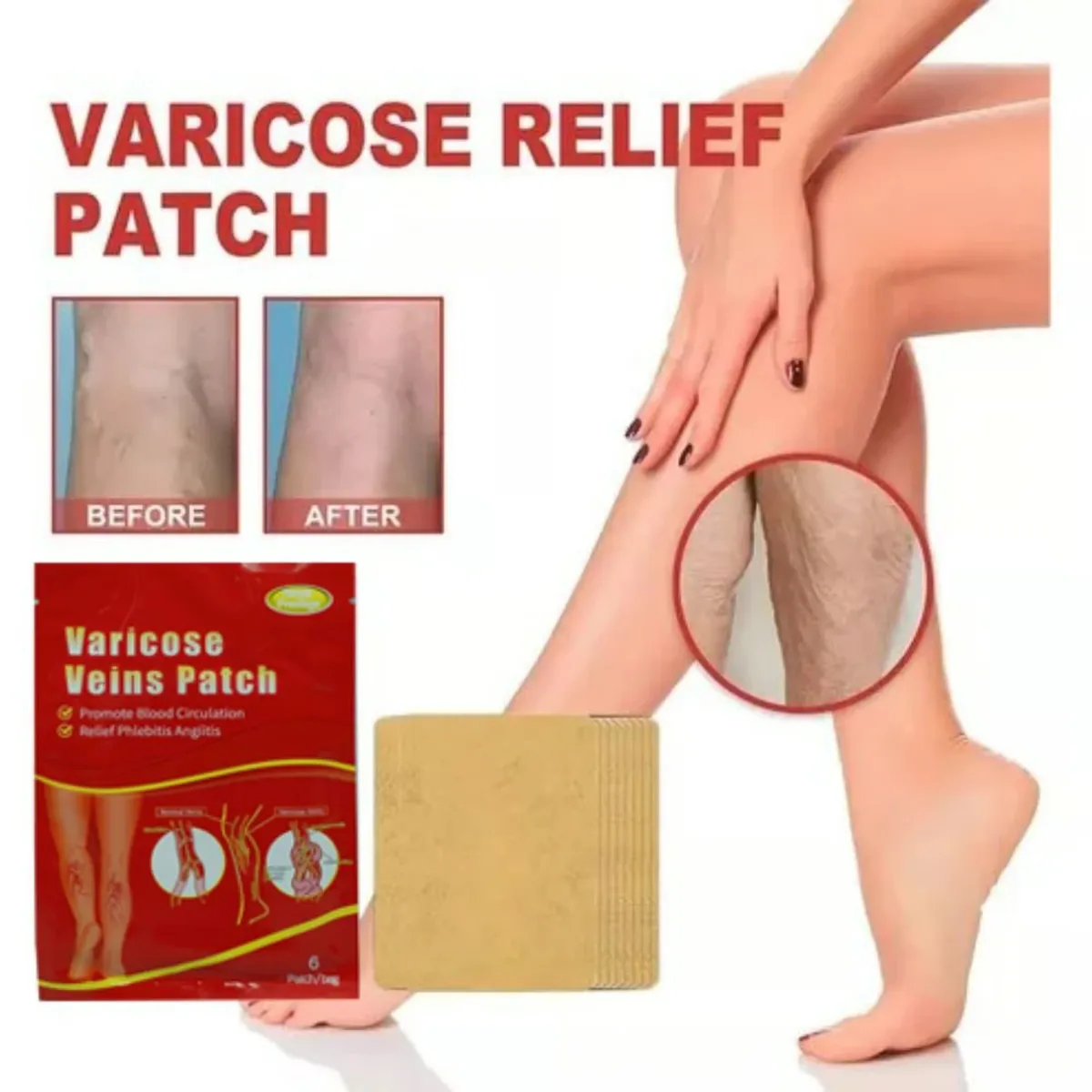 GENERICO - 3Sobre 18Parches Varicose para Varices Elimina Vena Hinchada