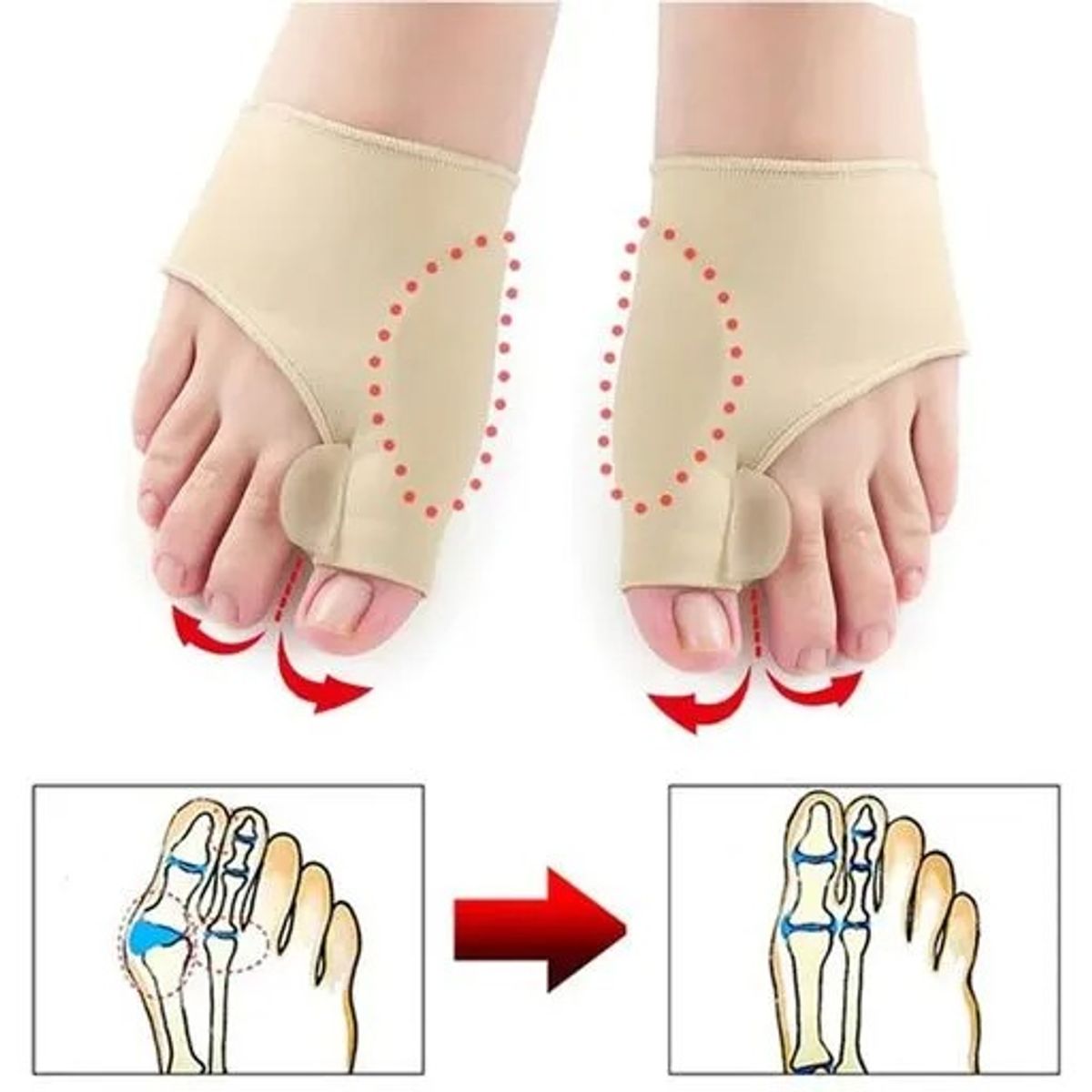 OEM - Ferula Corrector de Licra Para Juanete Dedo Pie Hallux Valgus