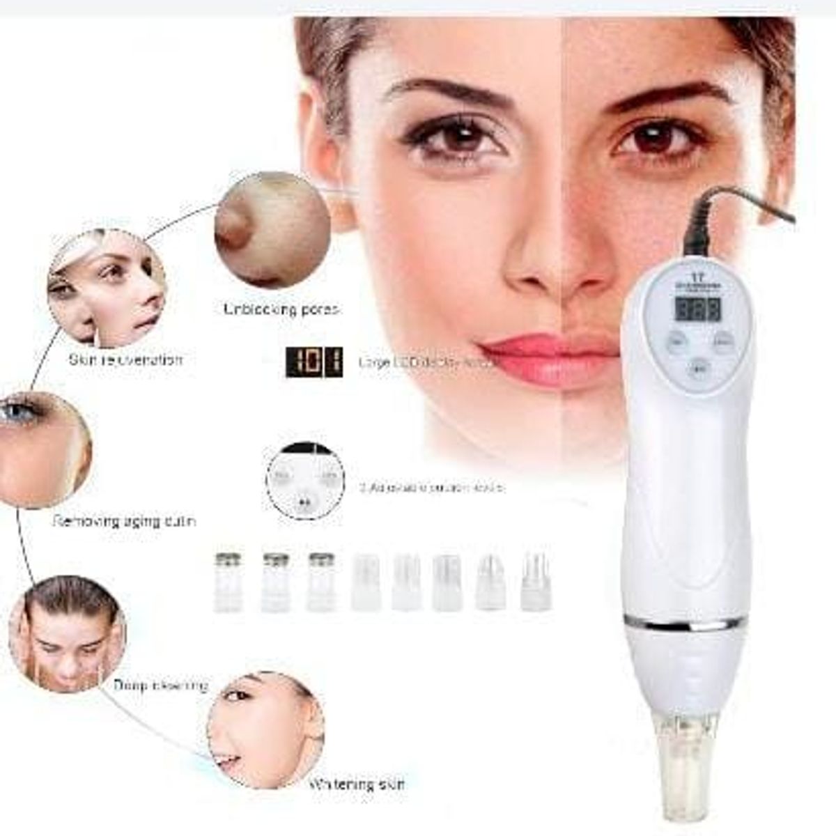 GENERICO - Microdermoabrasión Facial Peeling Limpieza de Poros con 6 puntas