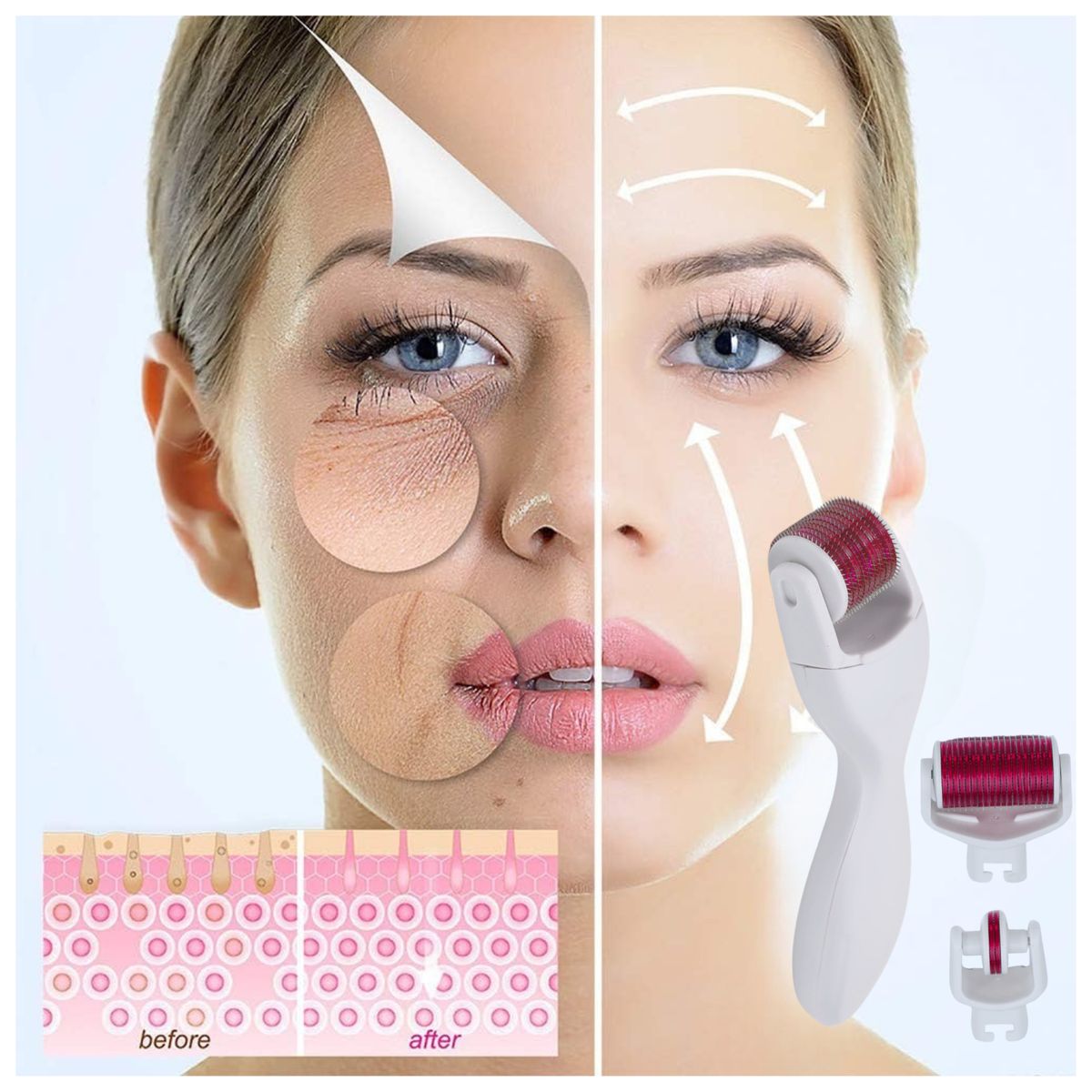 ROHS - Derma Roller Rodillo de Mesoterapia 4 en 1