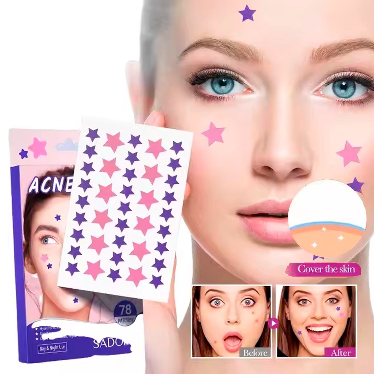 GENERICO - 78 Parches Anti Acné de Hidrocoloides de Estrella para Espinillas