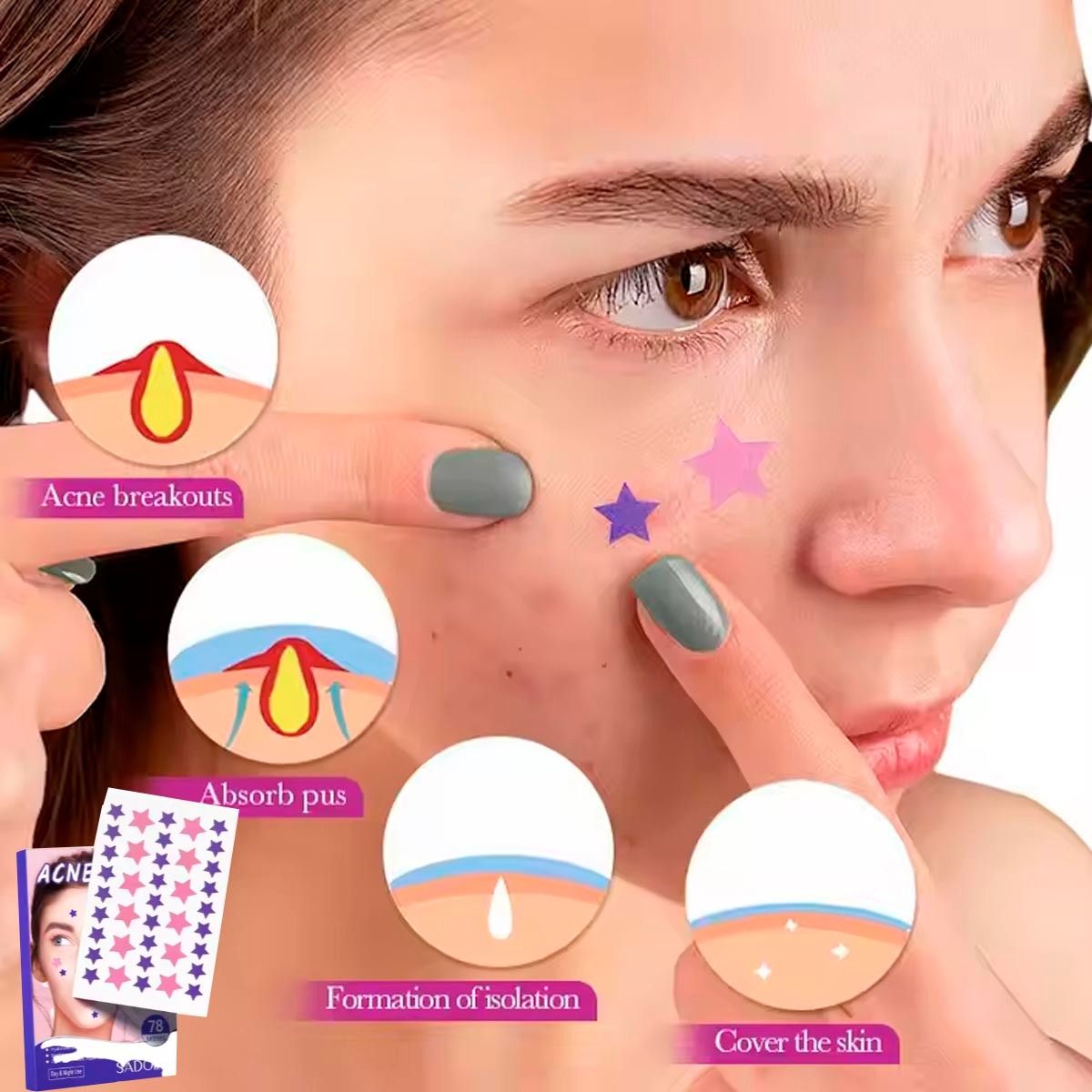 GENERICO - 78 Parches Estrella Anti Acné de Hidrocoloides