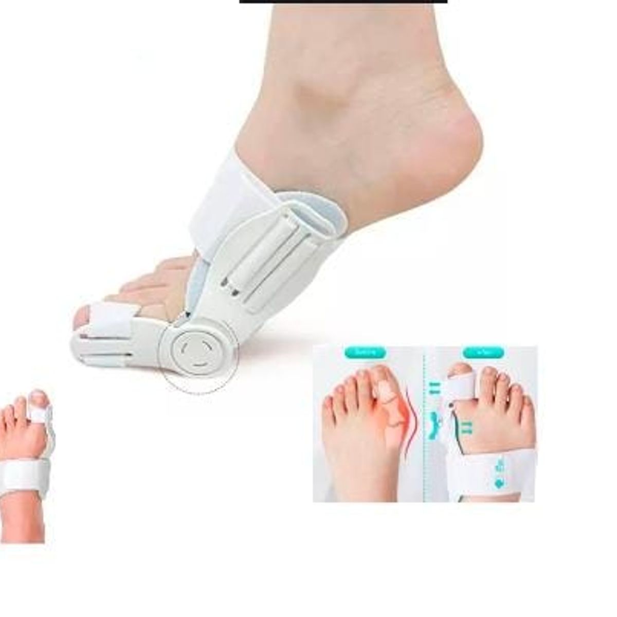 GENERICO - Corrector ortopédico de juanetes de huesos