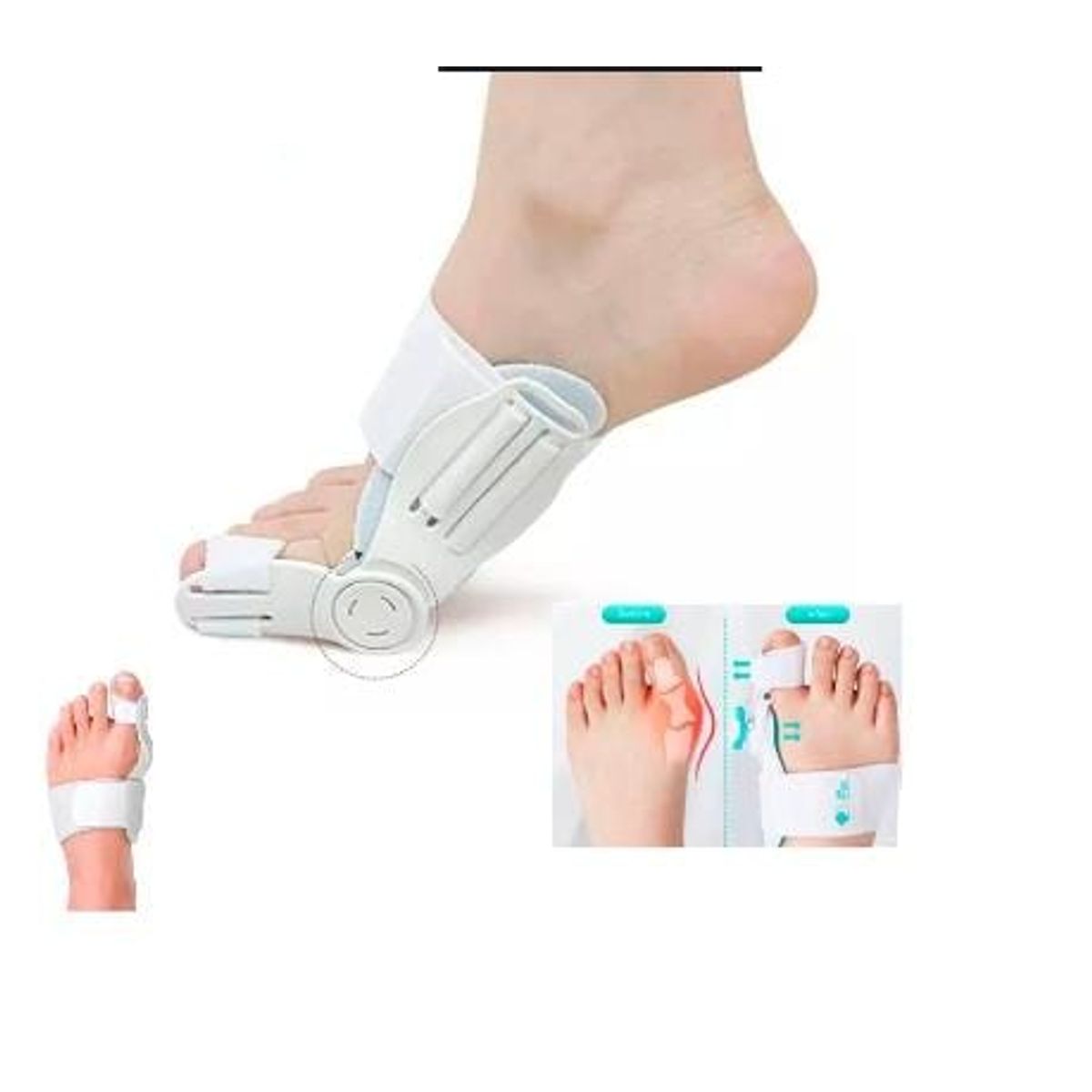 GENERICO - Corrector ortopédico de juanetes de huesos