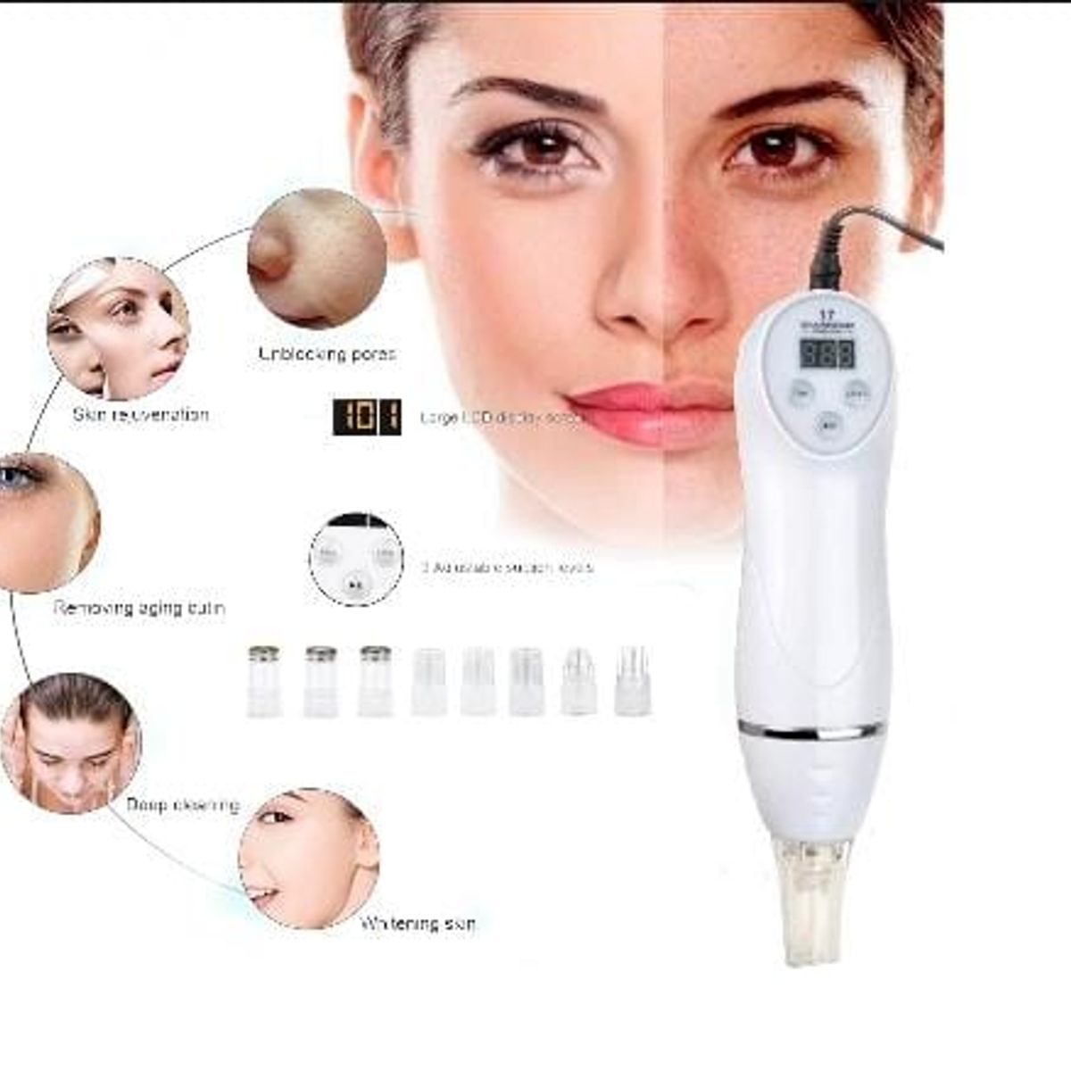 GENERICO - Máquina Removedora De Succión Al Vacío De 6 Puntas