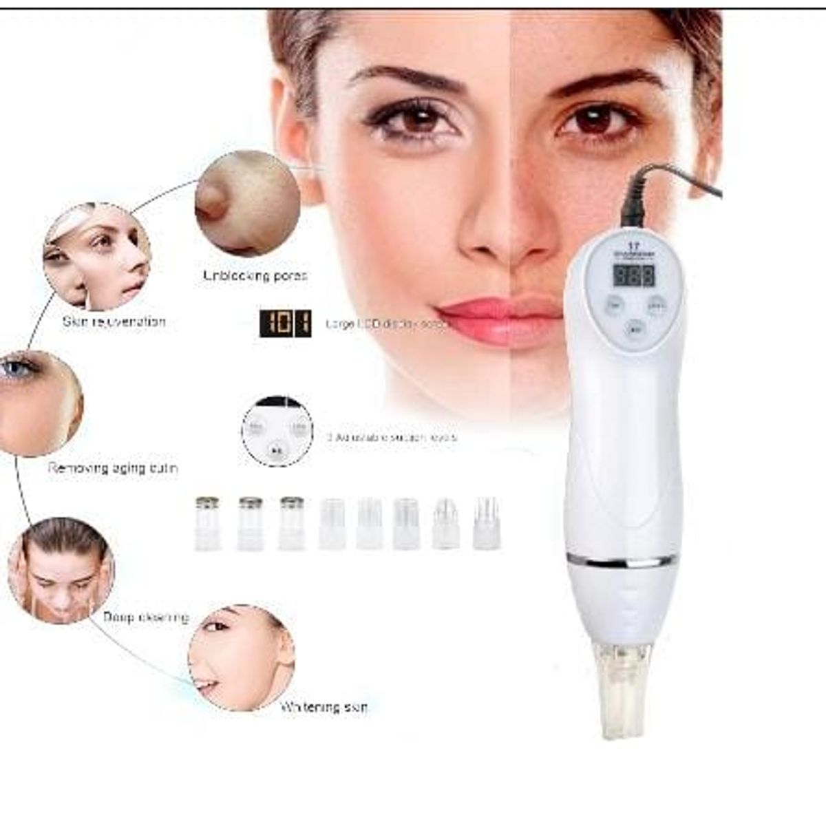 GENERICO - Máquina Removedora De Succión Al Vacío De 6 Puntas