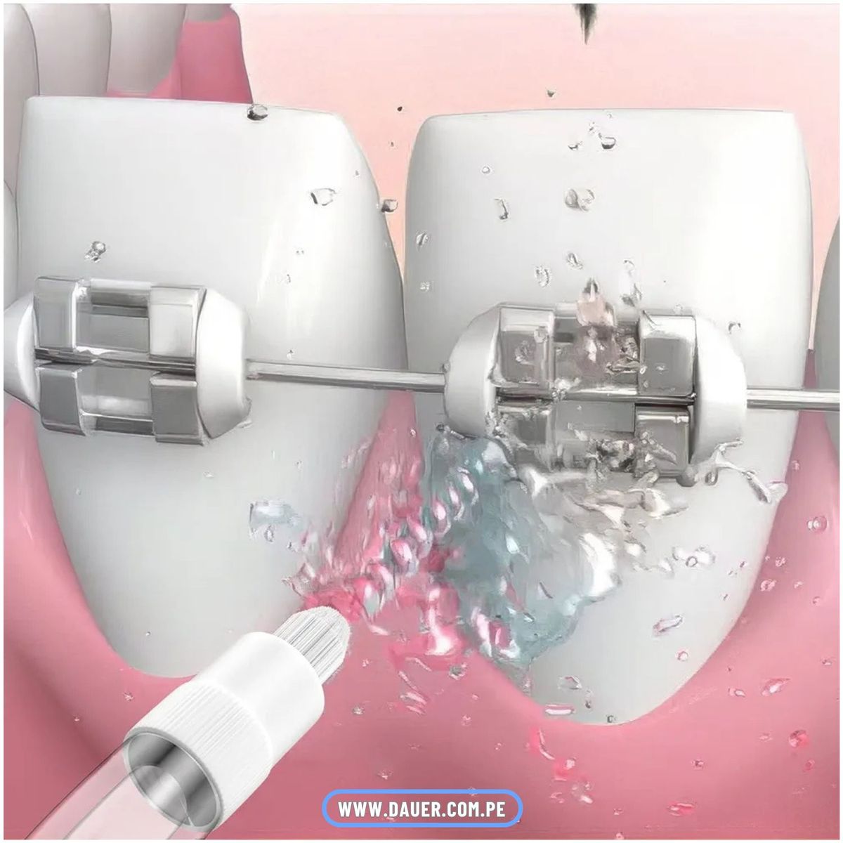 DAUER - KIT 7 Boquillas de Repuesto Irrigador Dental Limpieza Bucal