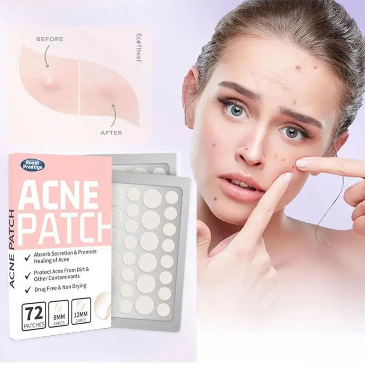 GENERICO - Parches Anti Acné Hidrocoloides Acne Patch 72 Pcs Espinillas Genieka