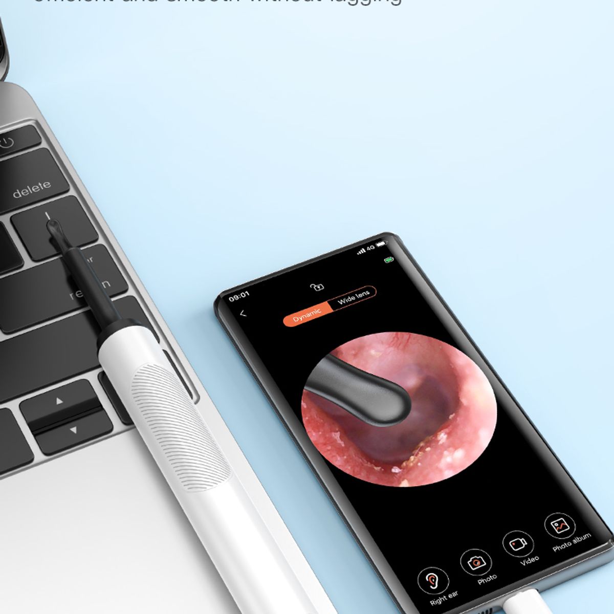 GENERICO - Otoscopio Digital Limpiador de oído con cámara cera oreja  - Hosal