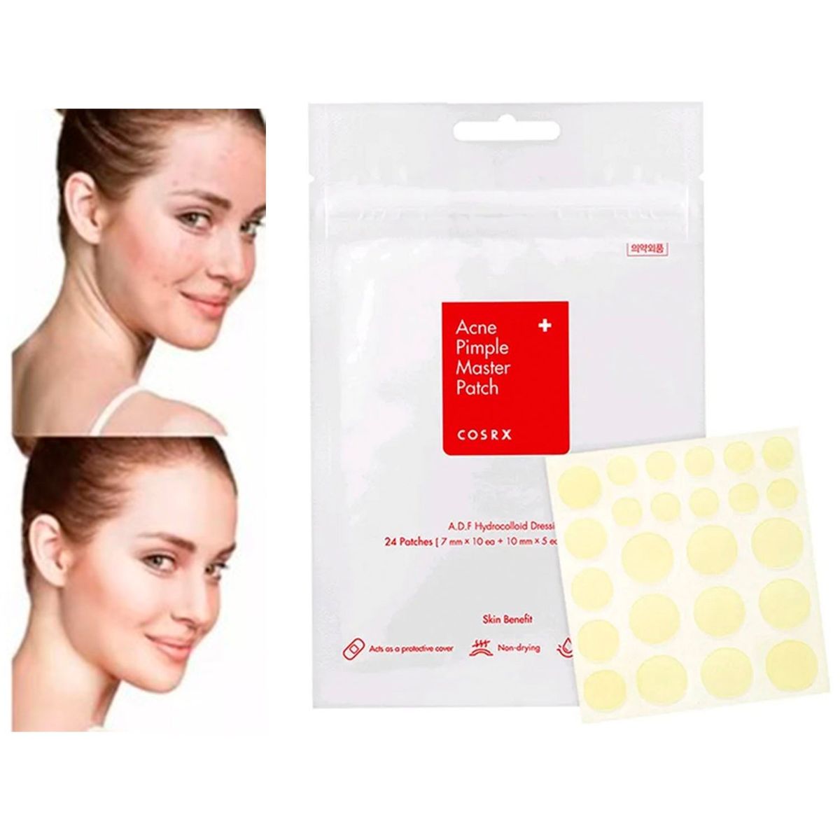 GENERICO - 24 Parches Para Remover Acné De Hidrocoloide