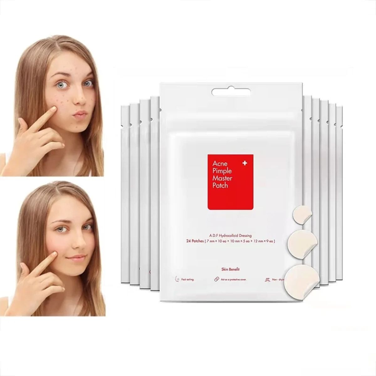 GENERICO - 24 Parches Para eliminar Acné y granos De Hidrocoloide