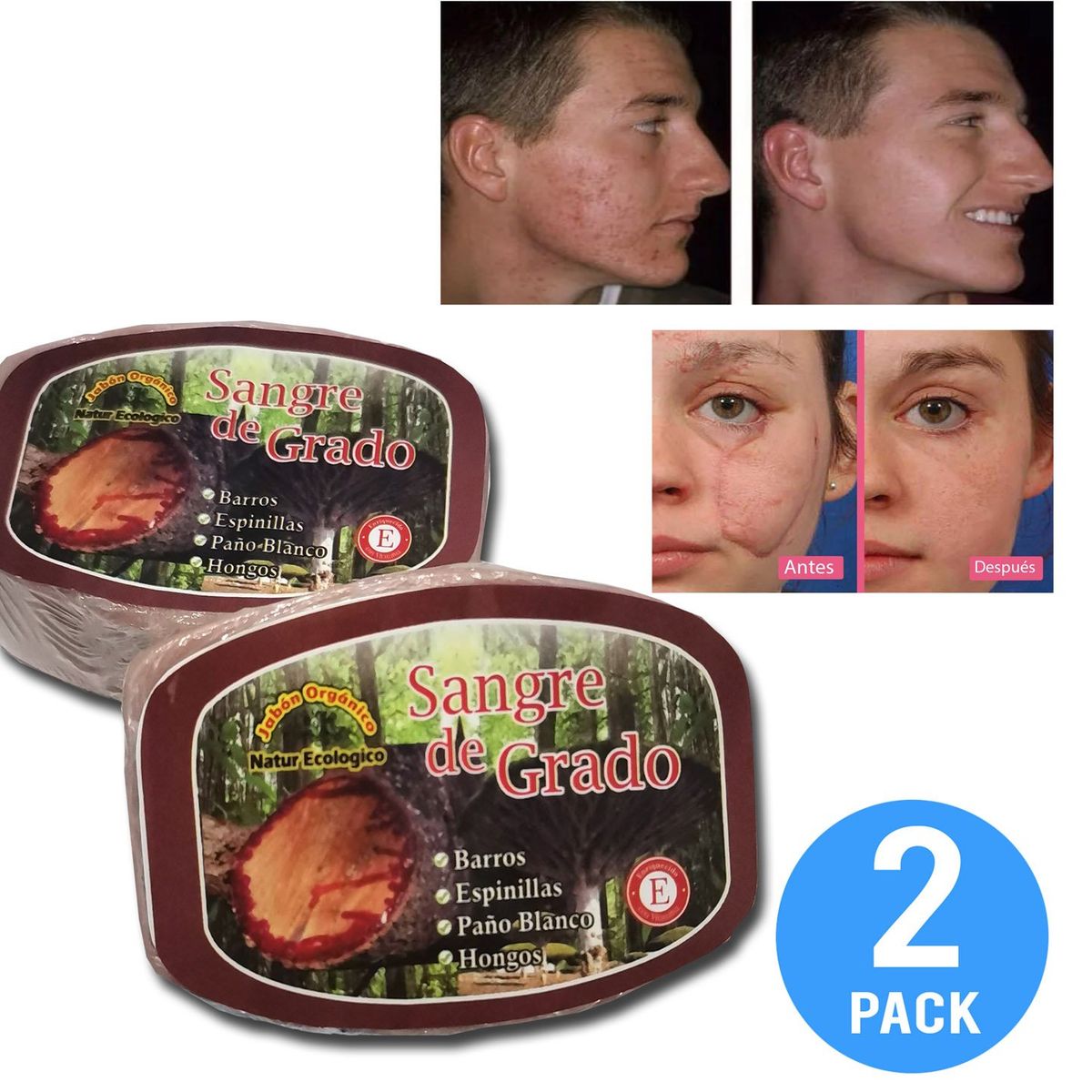 GENERICO - Jabón natural De Sangre De Grado para Acné , granos 2 UND