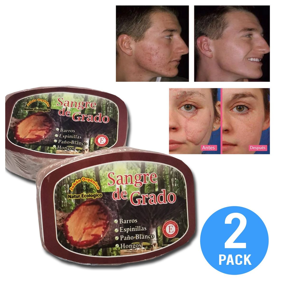GENERICO - Jabón natural De Sangre De Grado para Acné , granos 2 UND