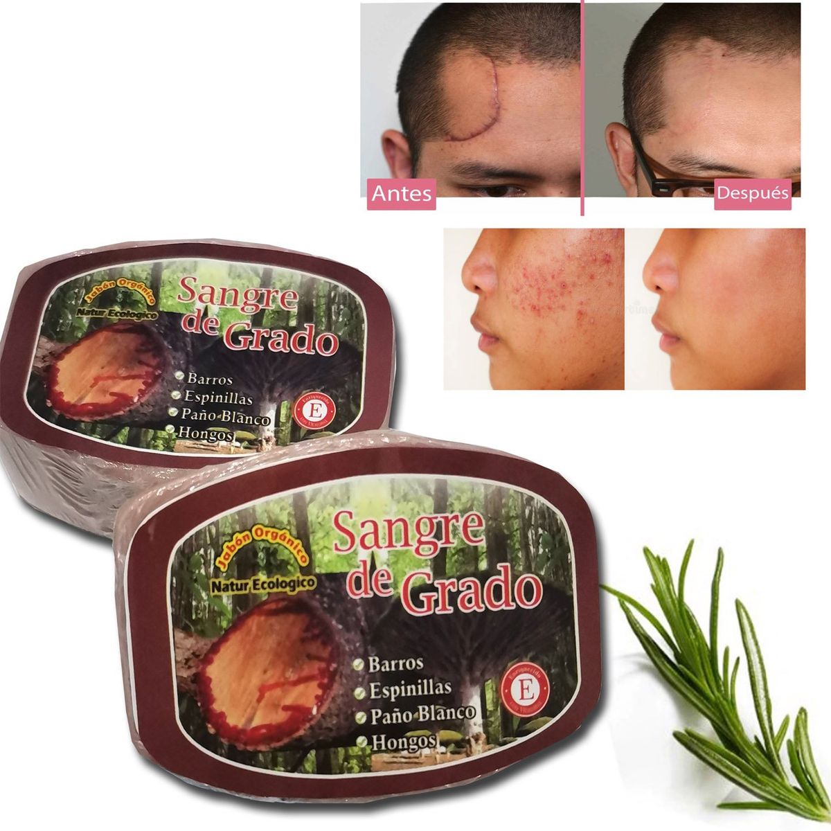 GENERICO - Jabón natural De Sangre De Grado para Acné , granos 2 UND