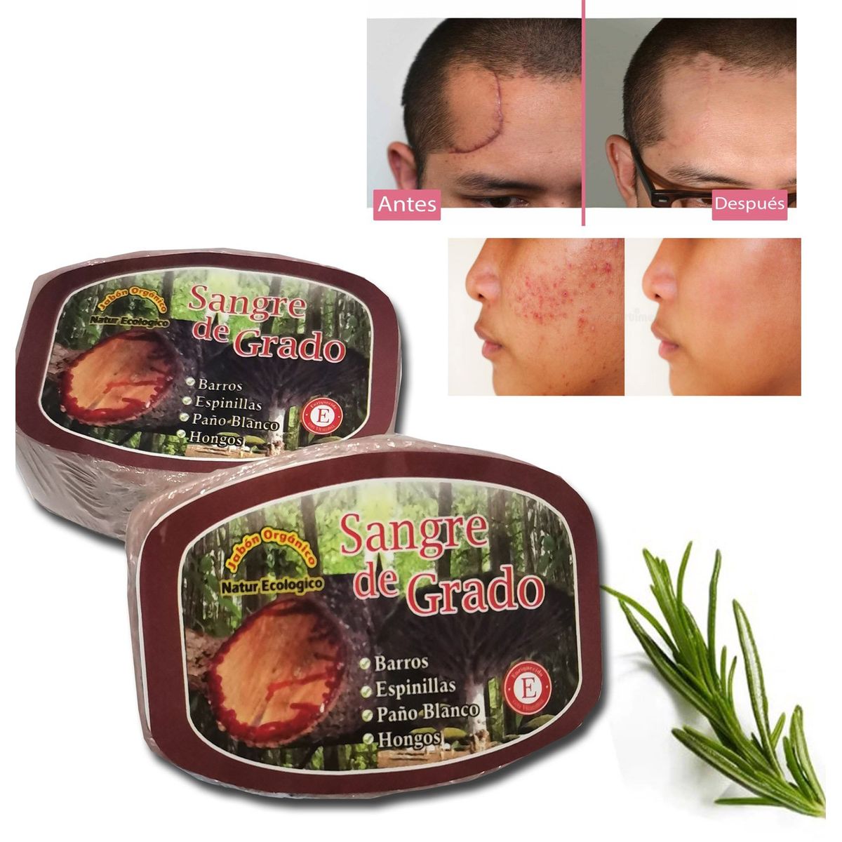 GENERICO - Jabón De Sangre De Grado para Acné , granos 2 UND