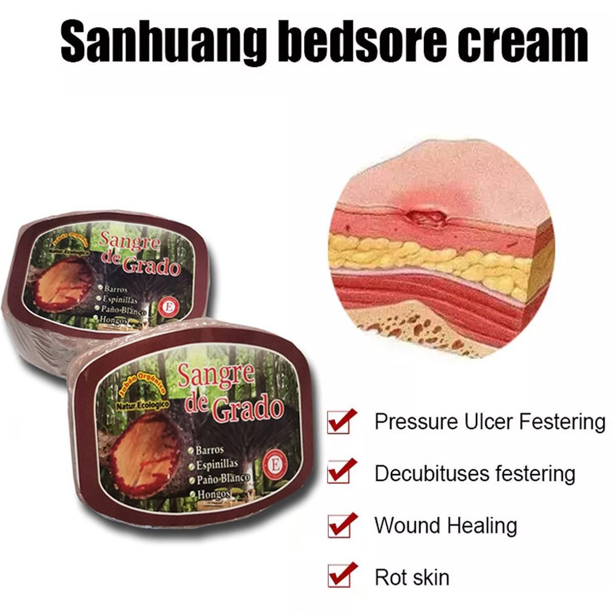 GENERICO - Jabón De Sangre De Grado para Acné y granos 2 unidades