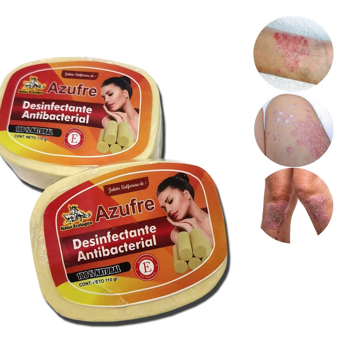 GENERICO - Jabon De Azufre Para Psoriasis, Eczemas, 2 und