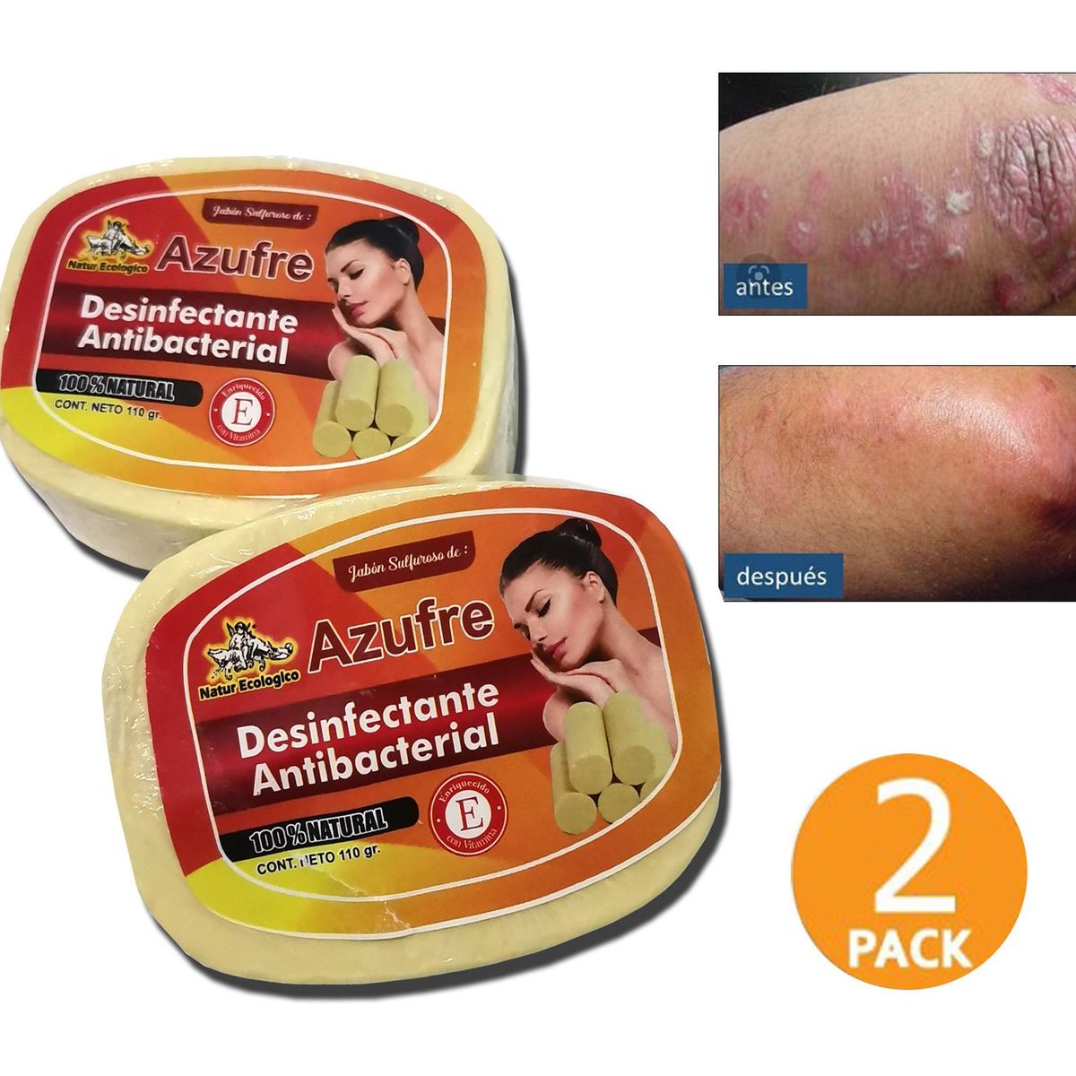 GENERICO - Jabon De Azufre Para Psoriasis, Eczemas, 2 und