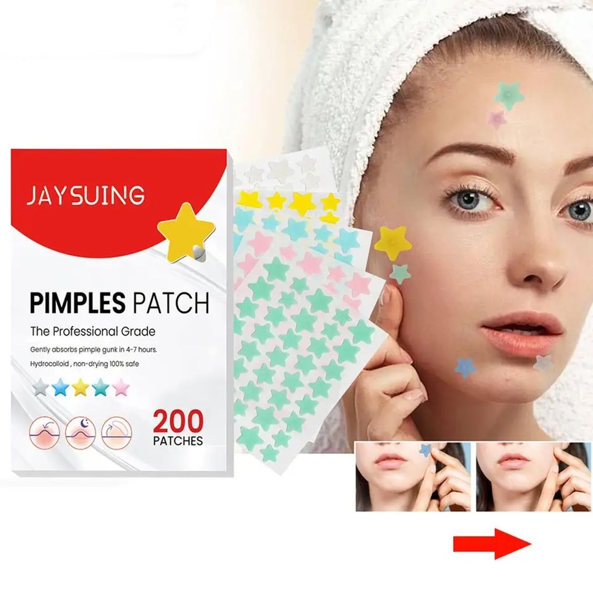 GENERICO - PIMPLE PATCH elimina acné y granos 200 parches