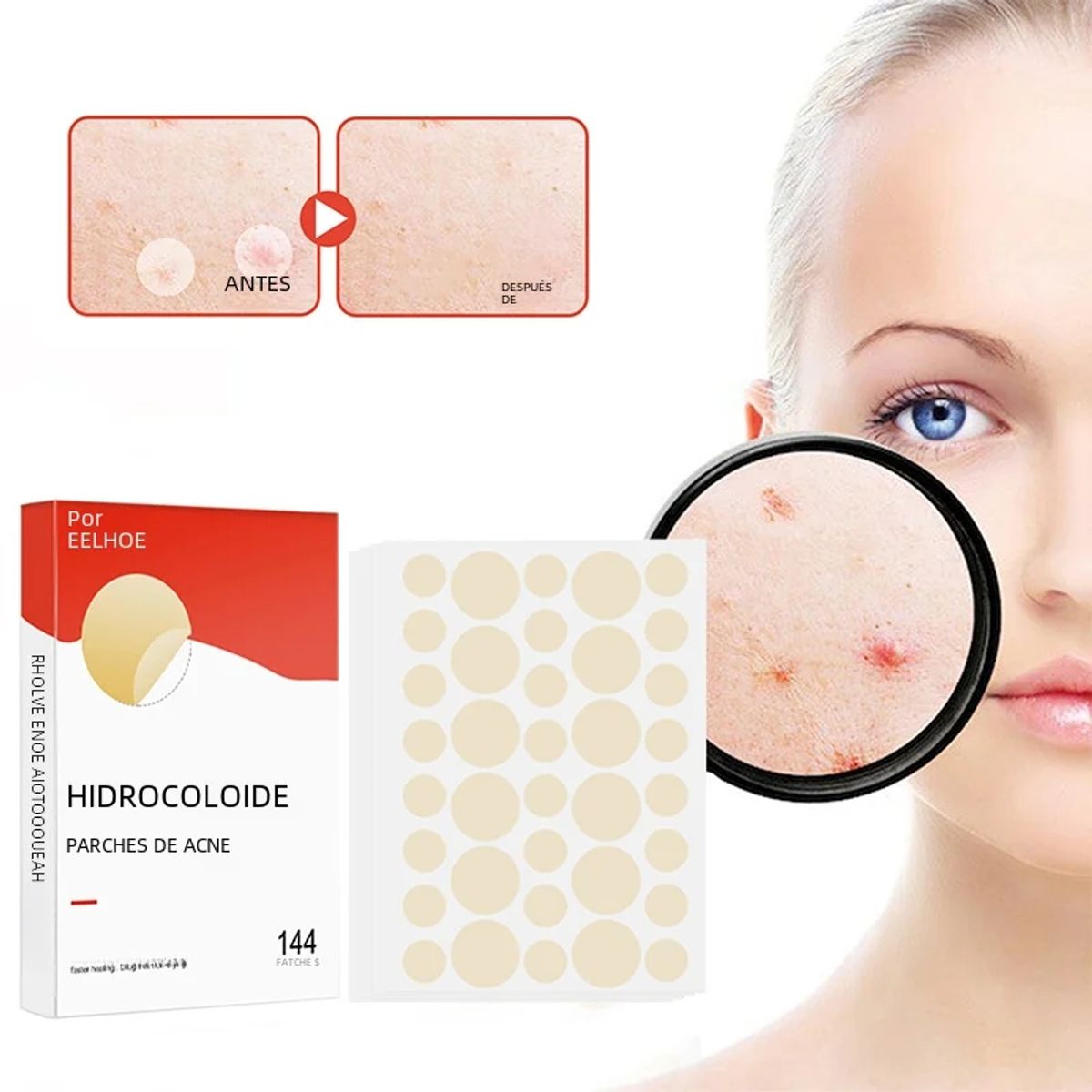 GENERICO - ACNE PATCH elimina acne y granos 144 Unidades