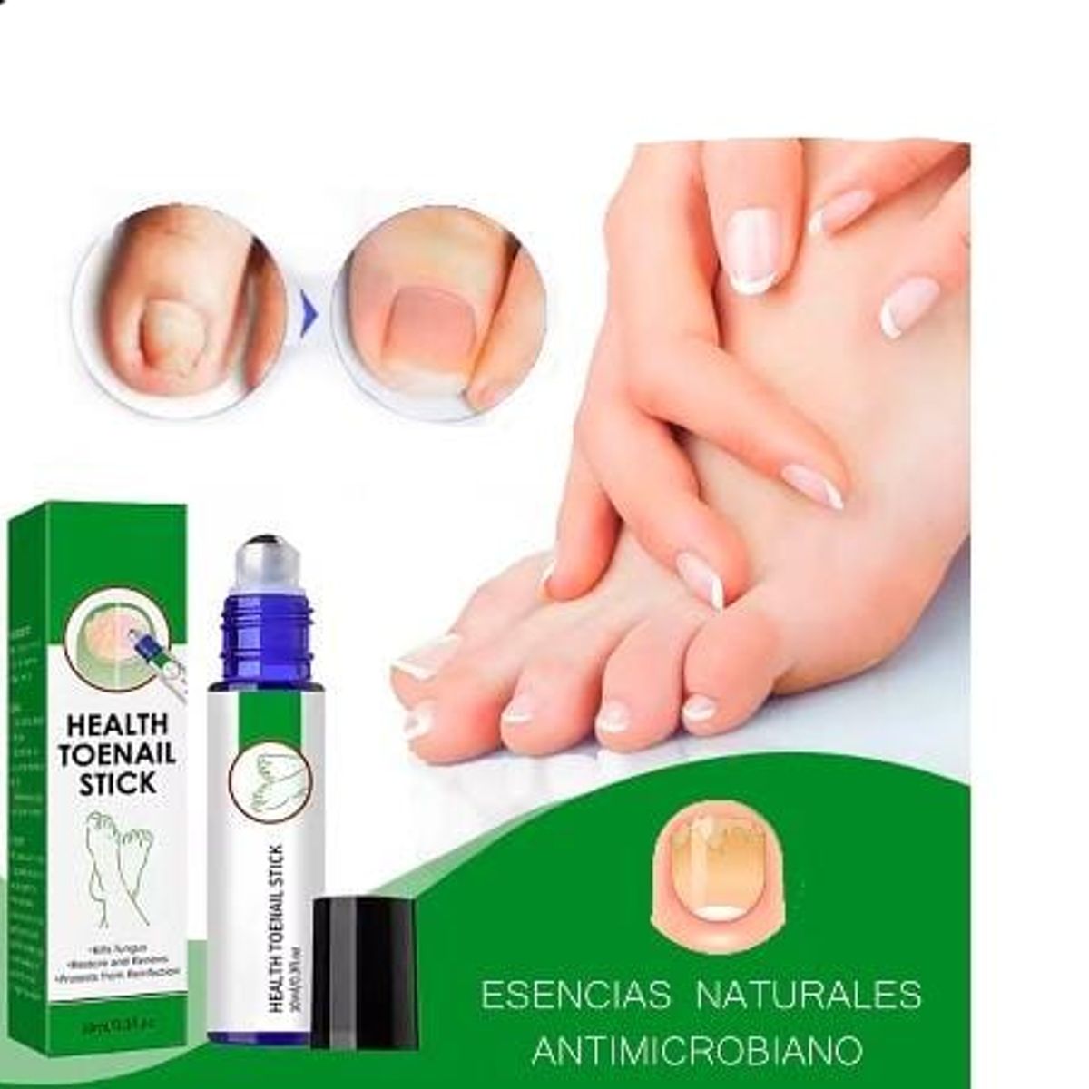 GENERICO - 2 ACEITE NATURAL REMOVEDOR DE HONGOS