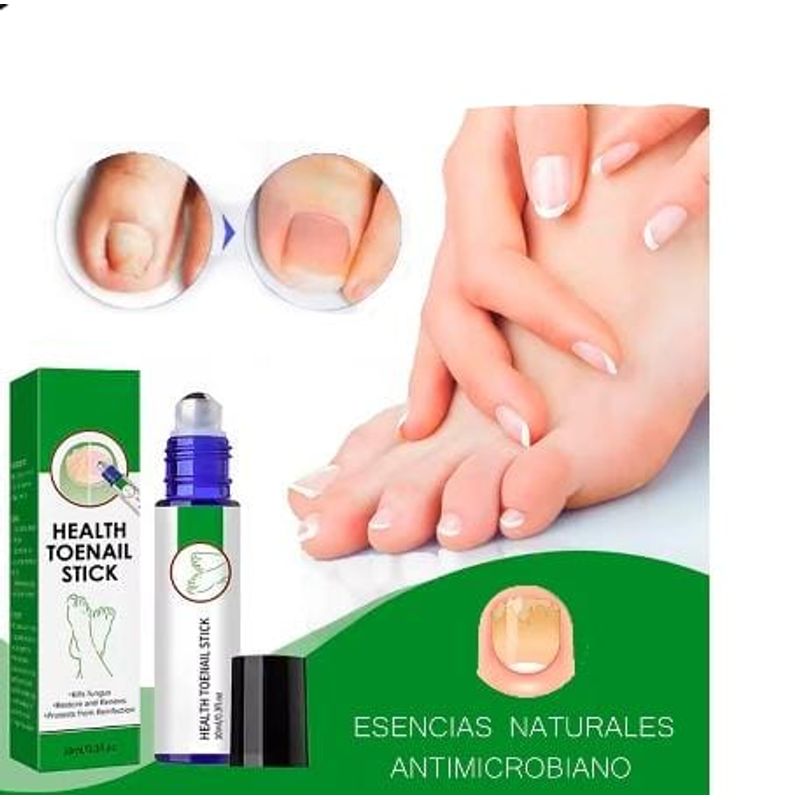 GENERICO - 2 ACEITE NATURAL REMOVEDOR DE HONGOS