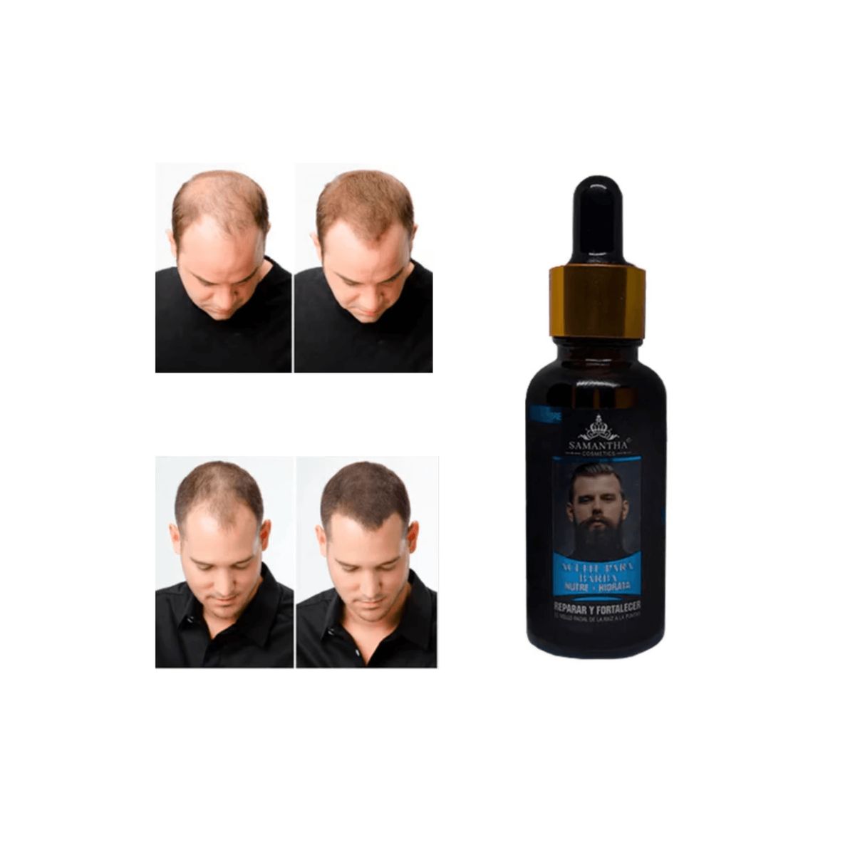 ROHS - Aceite fortalecedor de barba