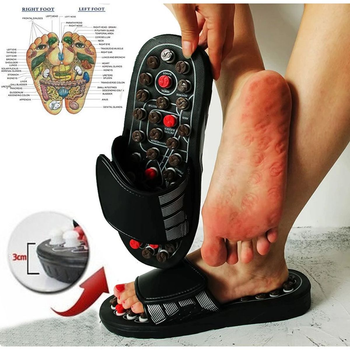 GENERICO - Masajeador Sandalias de Acupresión