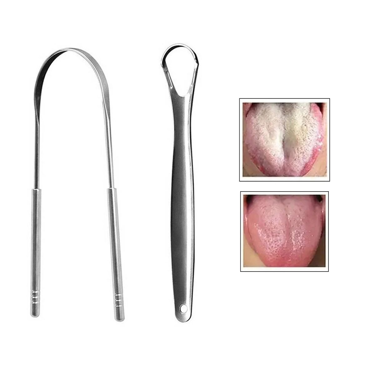 GENERICO - Limpiador Rascadores De Lengua Elimina Mal Aliento 2 unidades