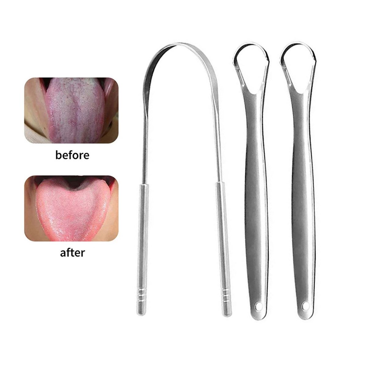 GENERICO - Limpiador De Lengua Elimina Mal Aliento 3 pcs