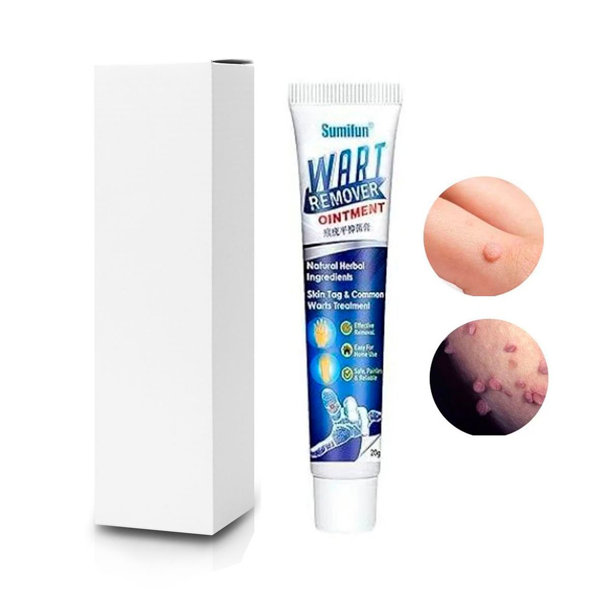 GENERICO - Sumifun removedor de verrugas y VPH