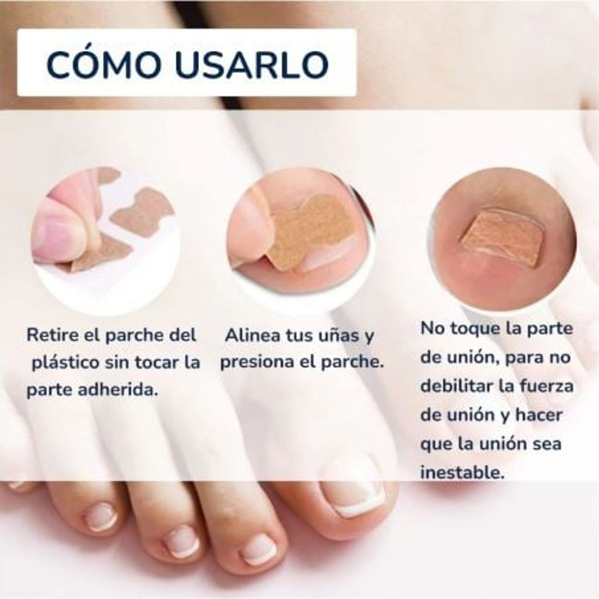 GENERICO - Parche de Corrección de Uñeros