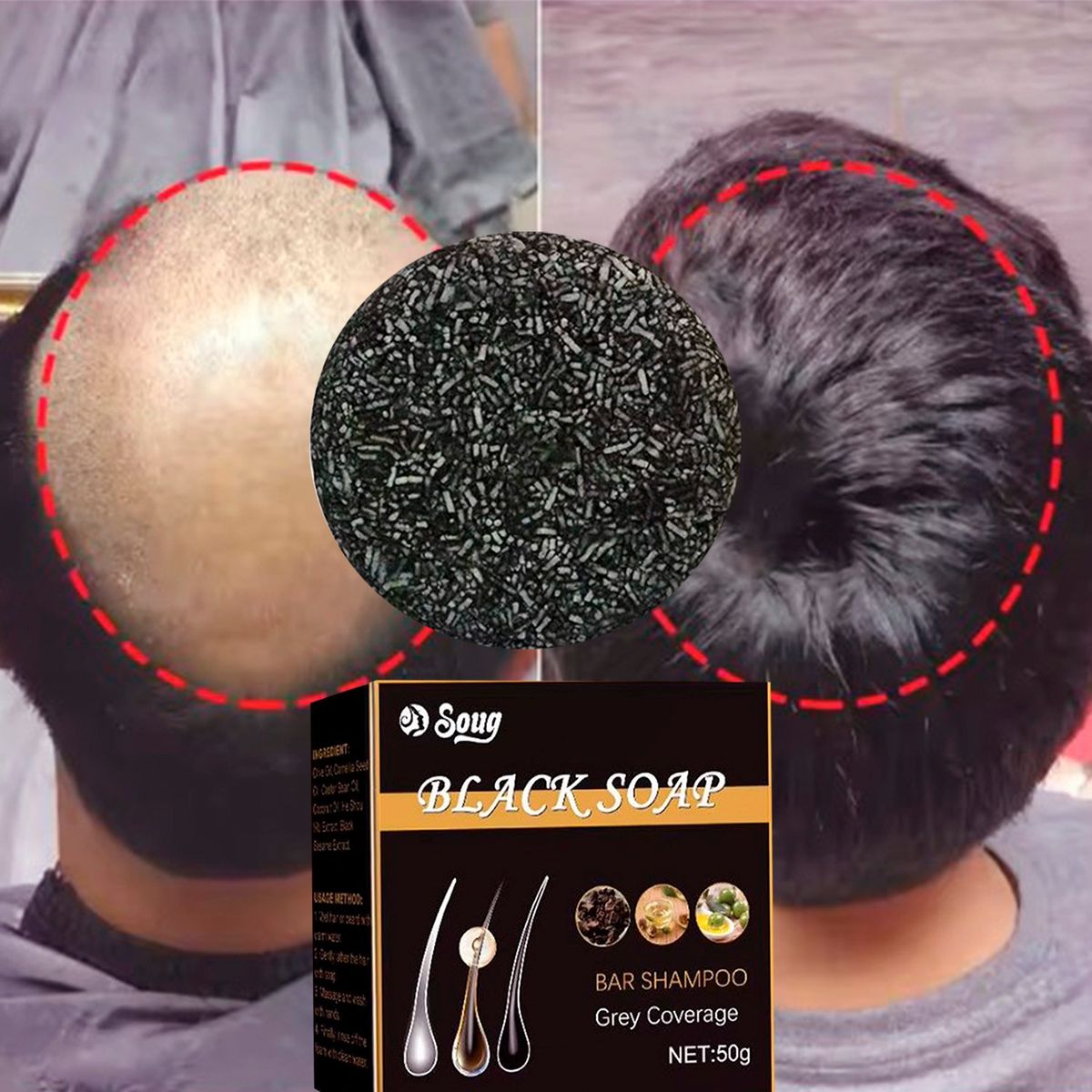 GENERICO - Jabón de carbon natural para la caida del cuero cabelludo