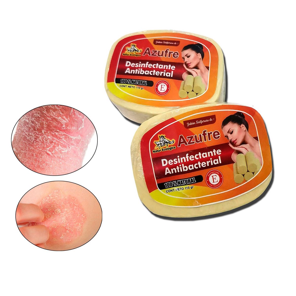 GENERICO - Jabón de azufre y crema reparador para soriasis