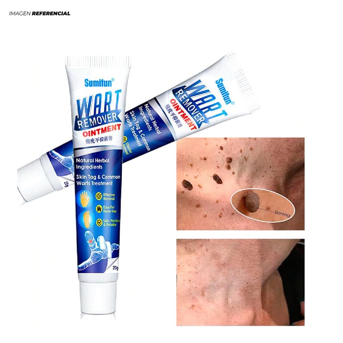 GENERICO - Removedor de Verruga en Crema Sumifum de 20gr