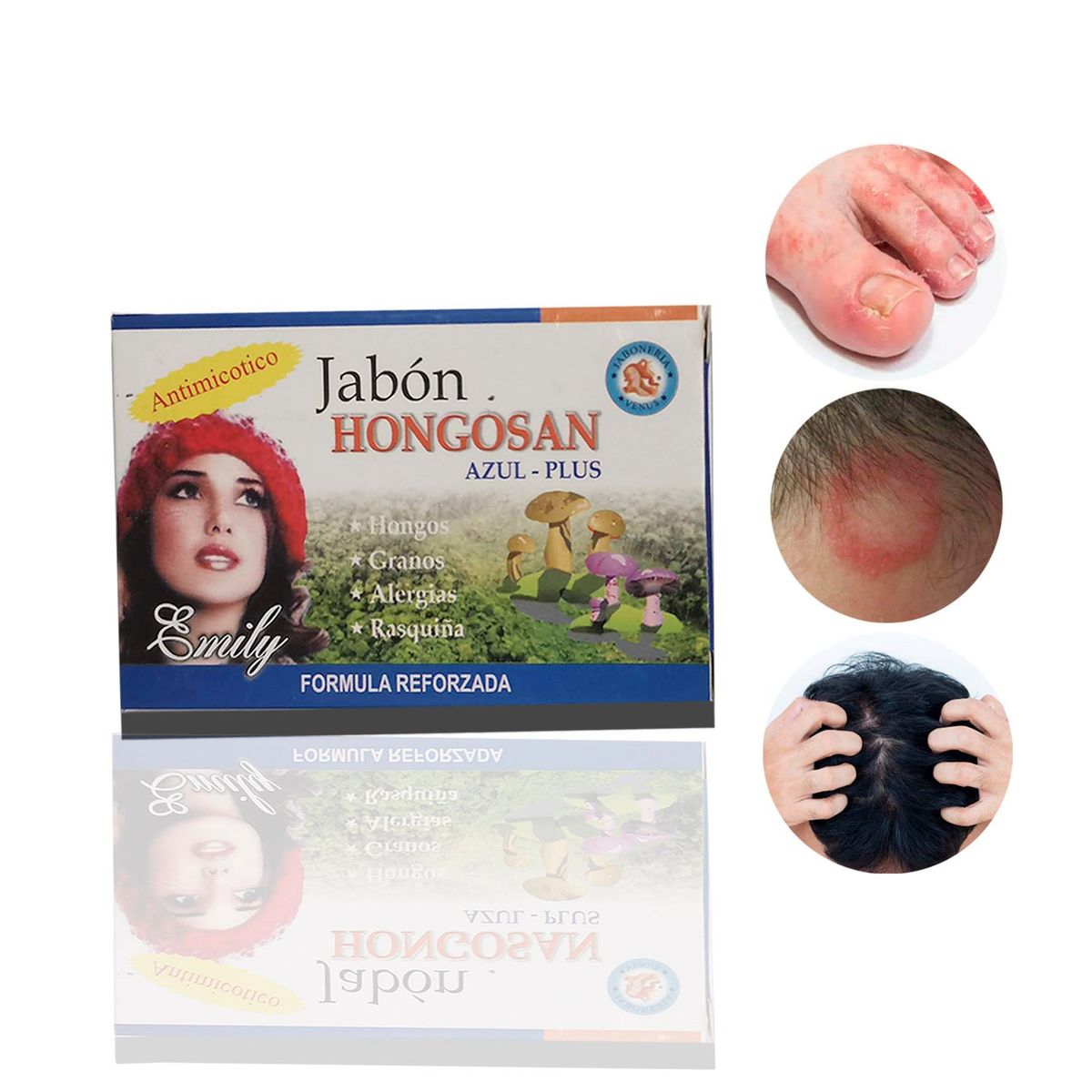 GENERICO - Jabon Medicinal Acné Psoriasis Seborrea Eczema Hongo