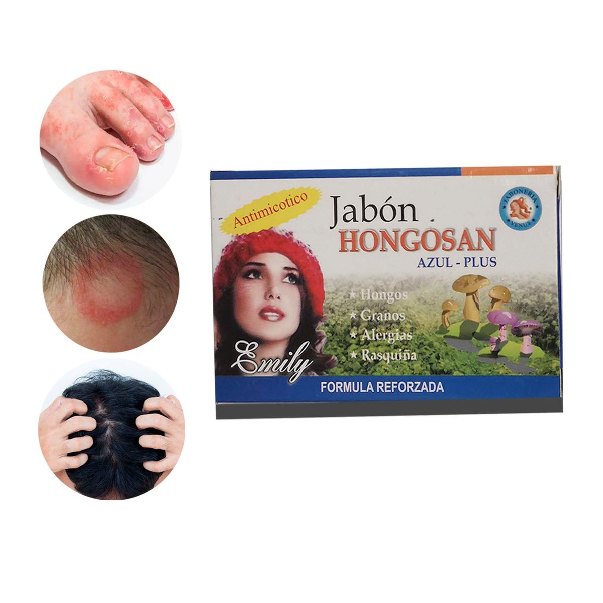 GENERICO - Jabon Medicinal Natural Para Hongos Tiña  Soriasis