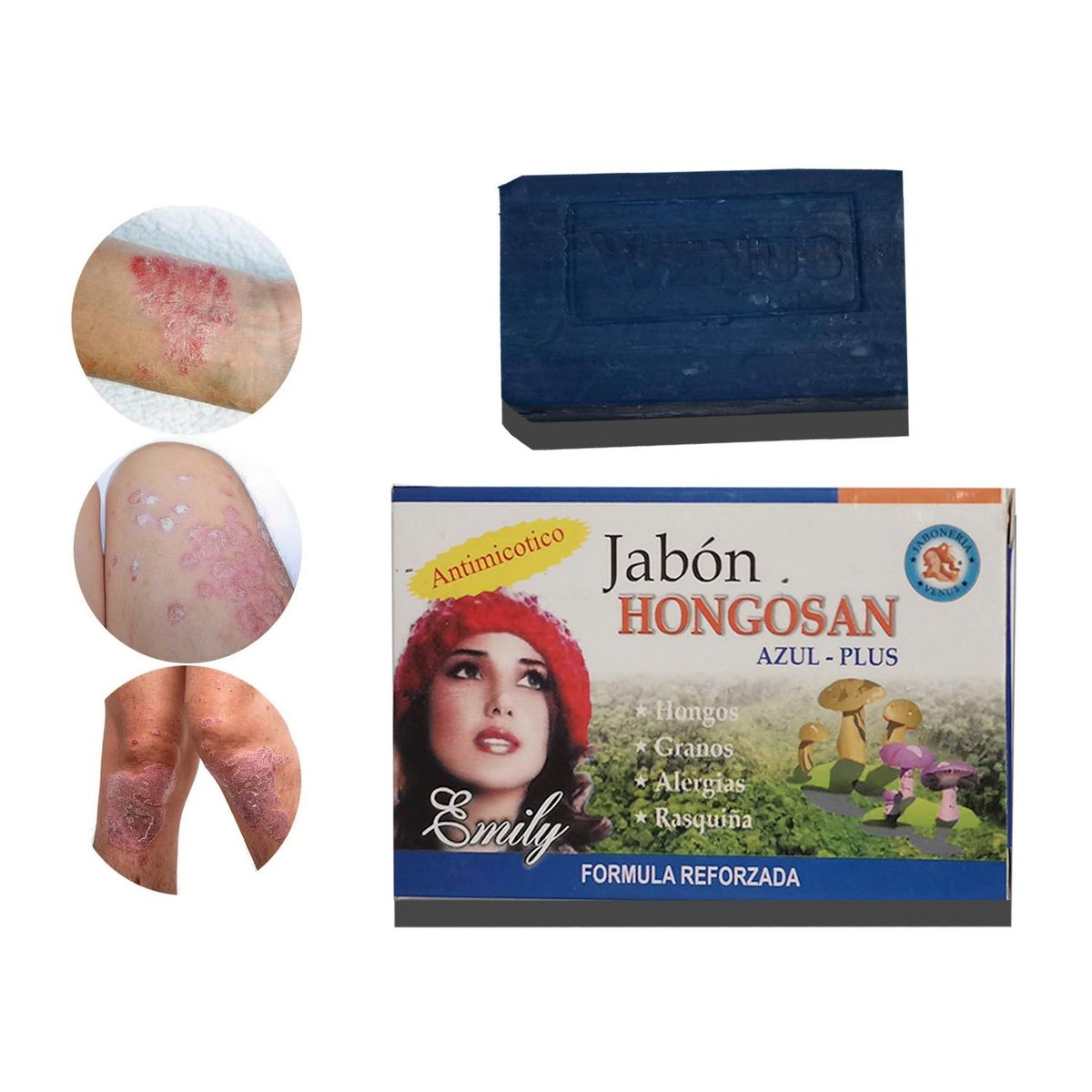 GENERICO - Jabon Medicinal Para Hongos Pie De Atleta Tiña