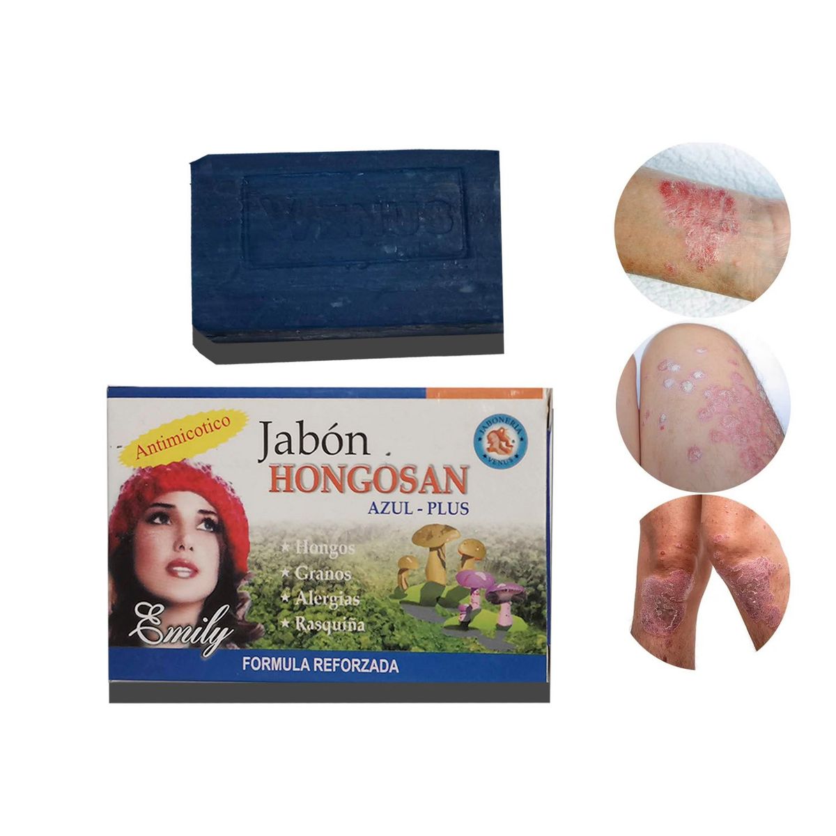 GENERICO - Jabon Medicinal Para Hongos Pie De Atleta Tiña