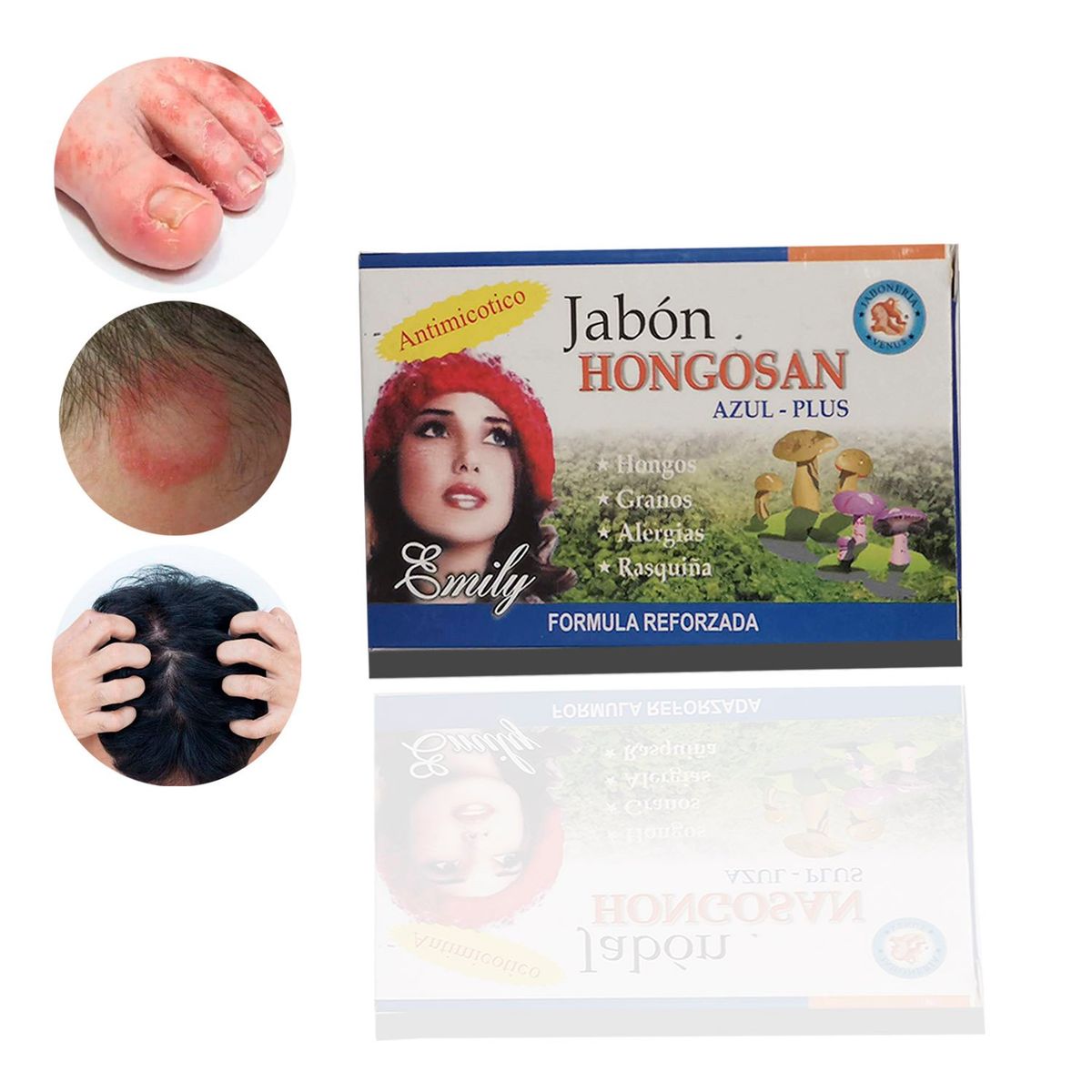 GENERICO - Jabon Medicinal Acné Psoriasis Seborrea Eczema 3 Unidades