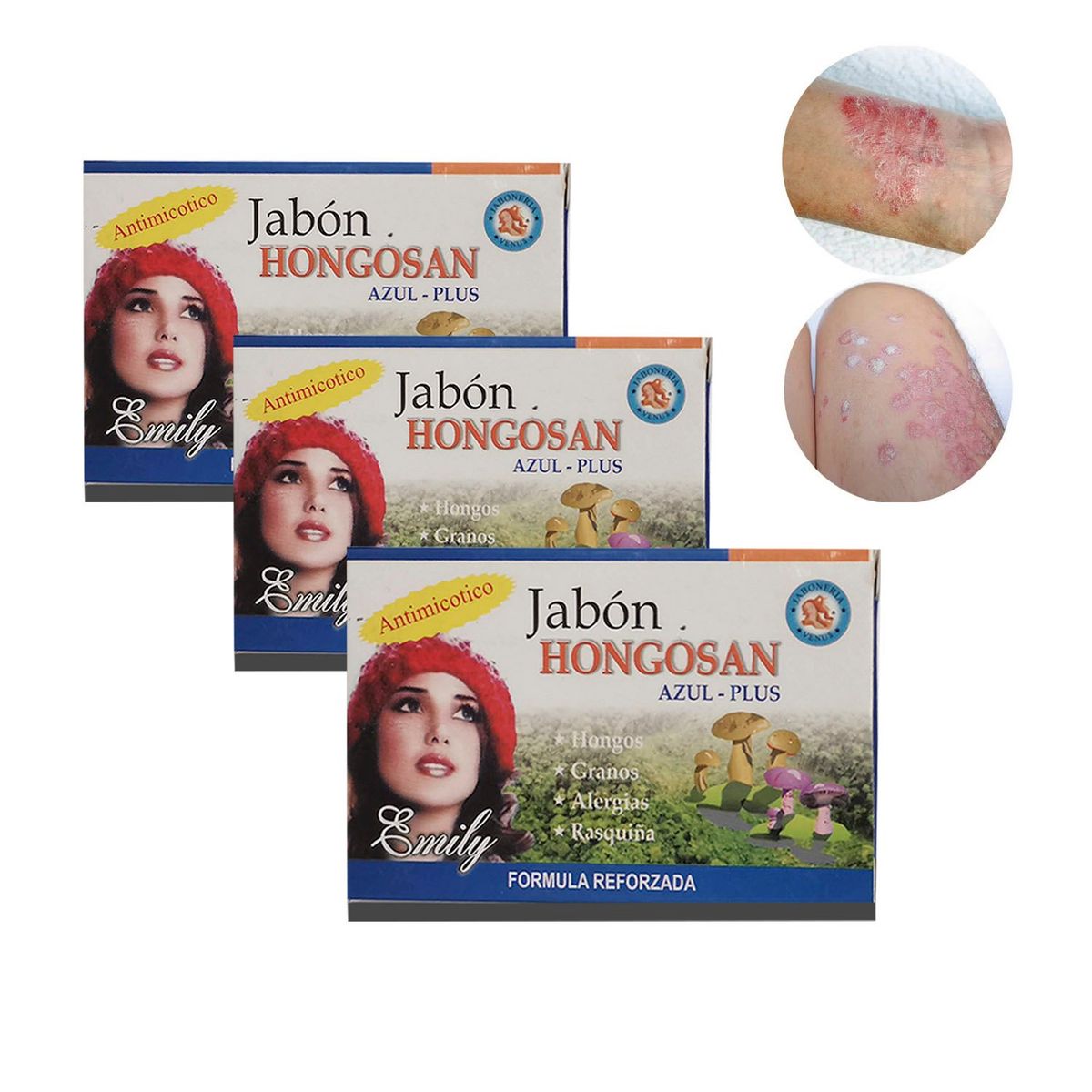 GENERICO - Jabon Medicinal Para Hongos Pie De Atleta Tiña  3 Und