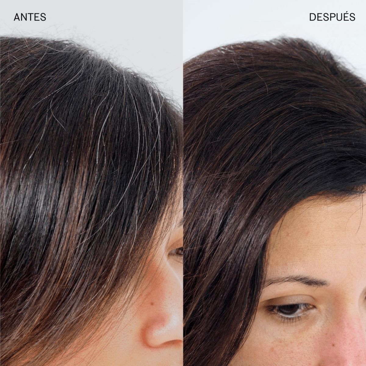 GENERICO - Shampoo anticanas Dr Rashel