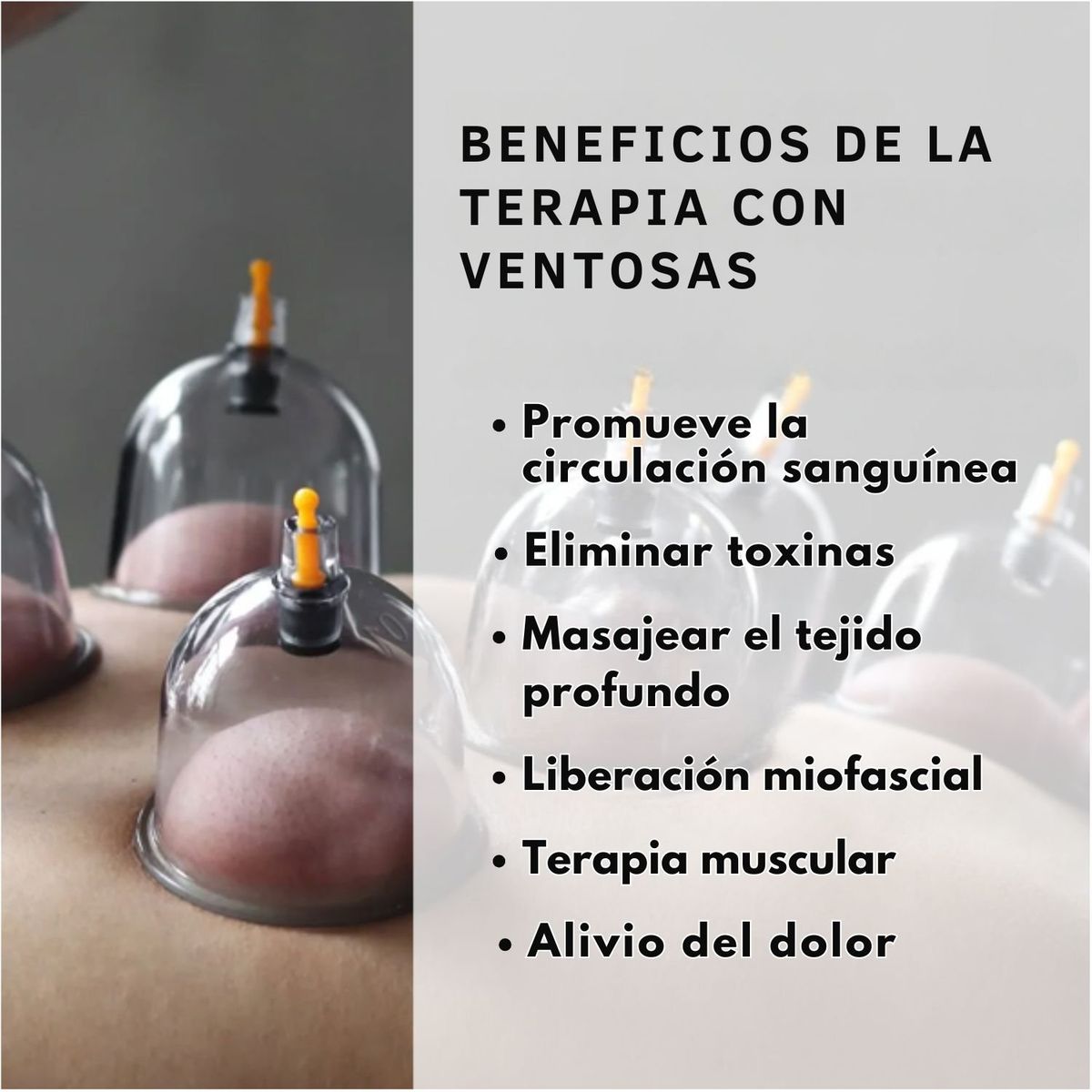 VICTORIA - Terapia de ventosas chinas 6 uds masaje, relajación y circulación