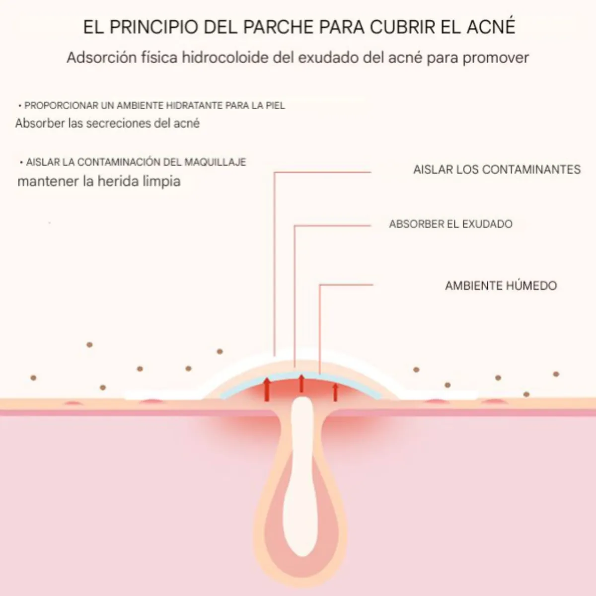 OEM - 200 Parches ANTI ACNÉ - ESPINILLAS de Hidrocoloides en  Estrella
