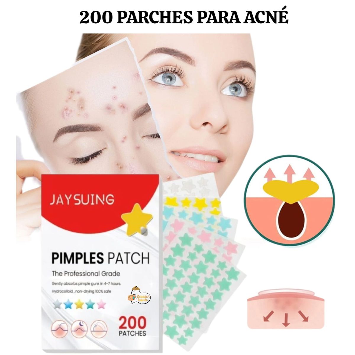 OEM - 200 Parches ANTI ACNÉ - ESPINILLAS de Hidrocoloides en  Estrella