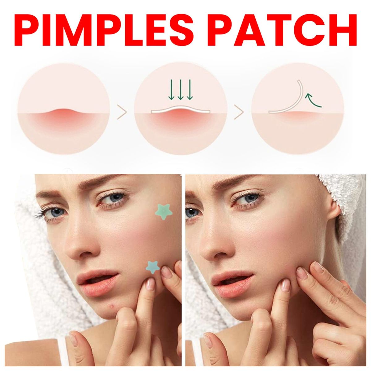 OEM - 400 Parches ANTI ACNÉ - ESPINILLAS de Hidrocoloides en  Estrella